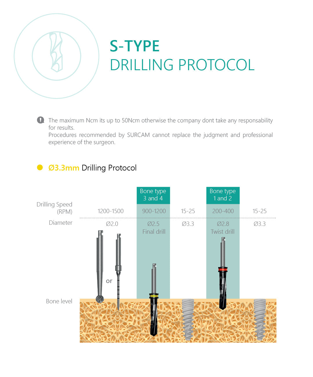 S-Type Dental Implant