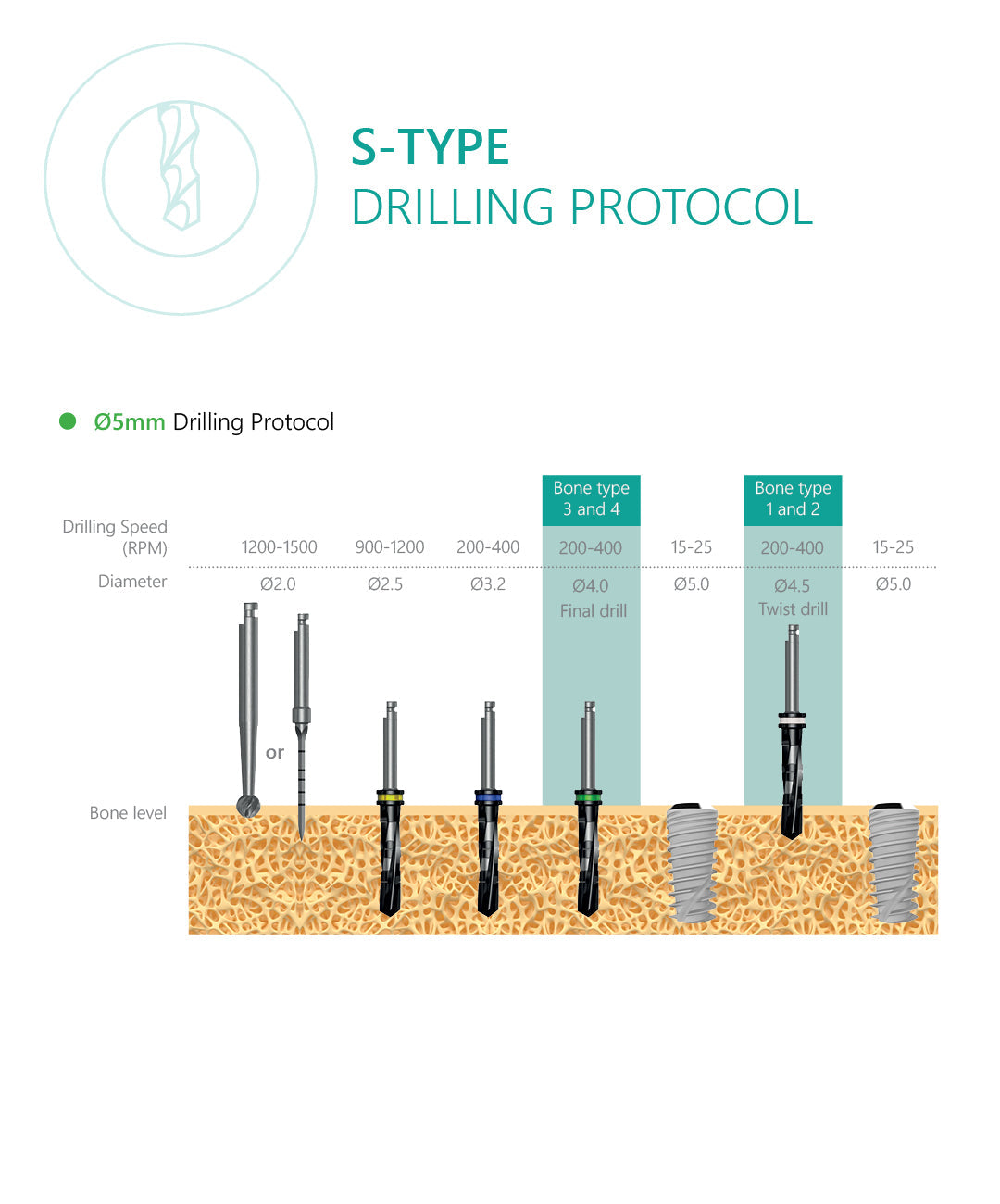 S-Type Dental Implant