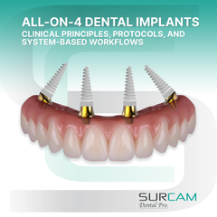 All-on-4 Dental Implants: Clinical Principles, Protocols, and System-Based Workflows
