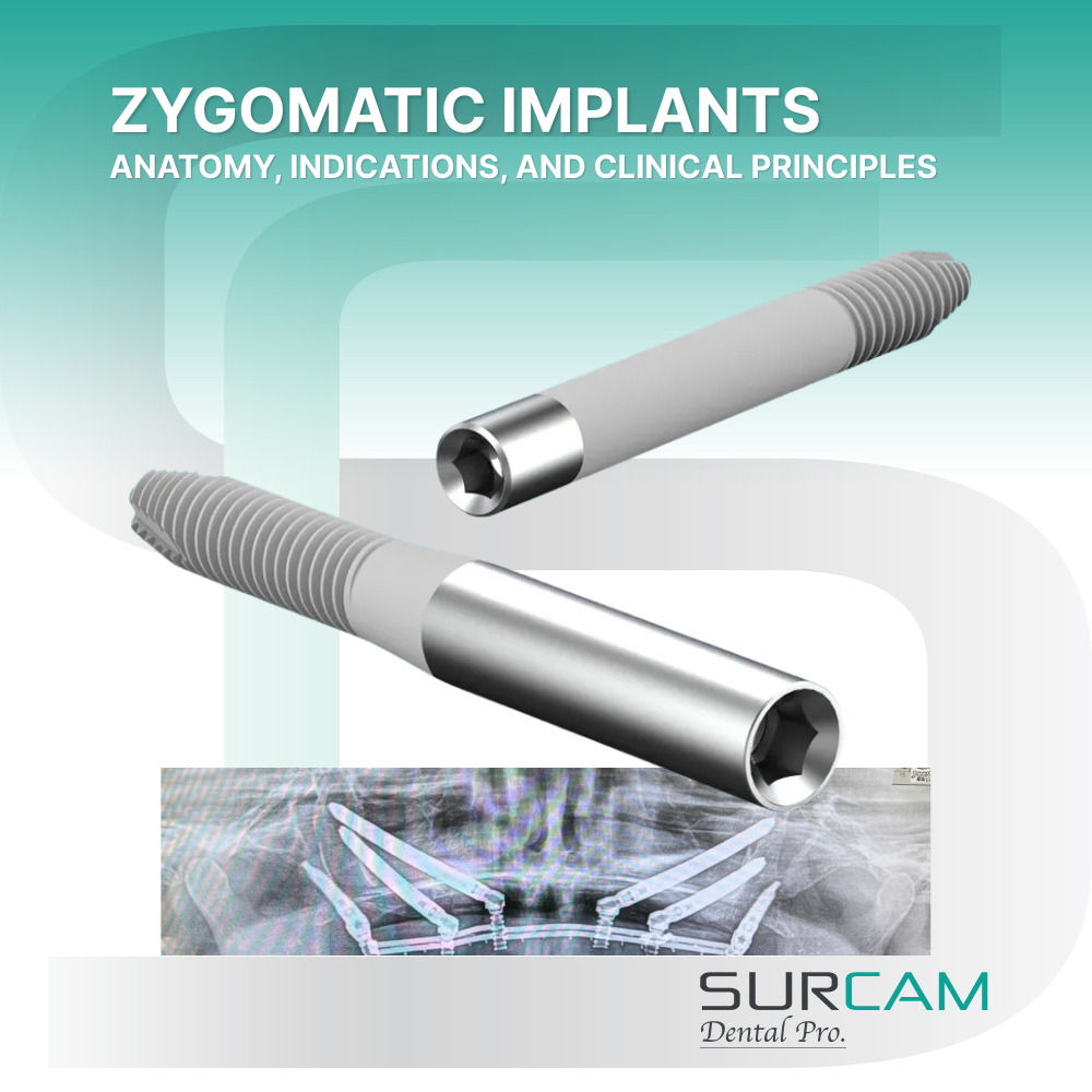 Zygomatic Implants: Anatomy, Indications, and Clinical Principles