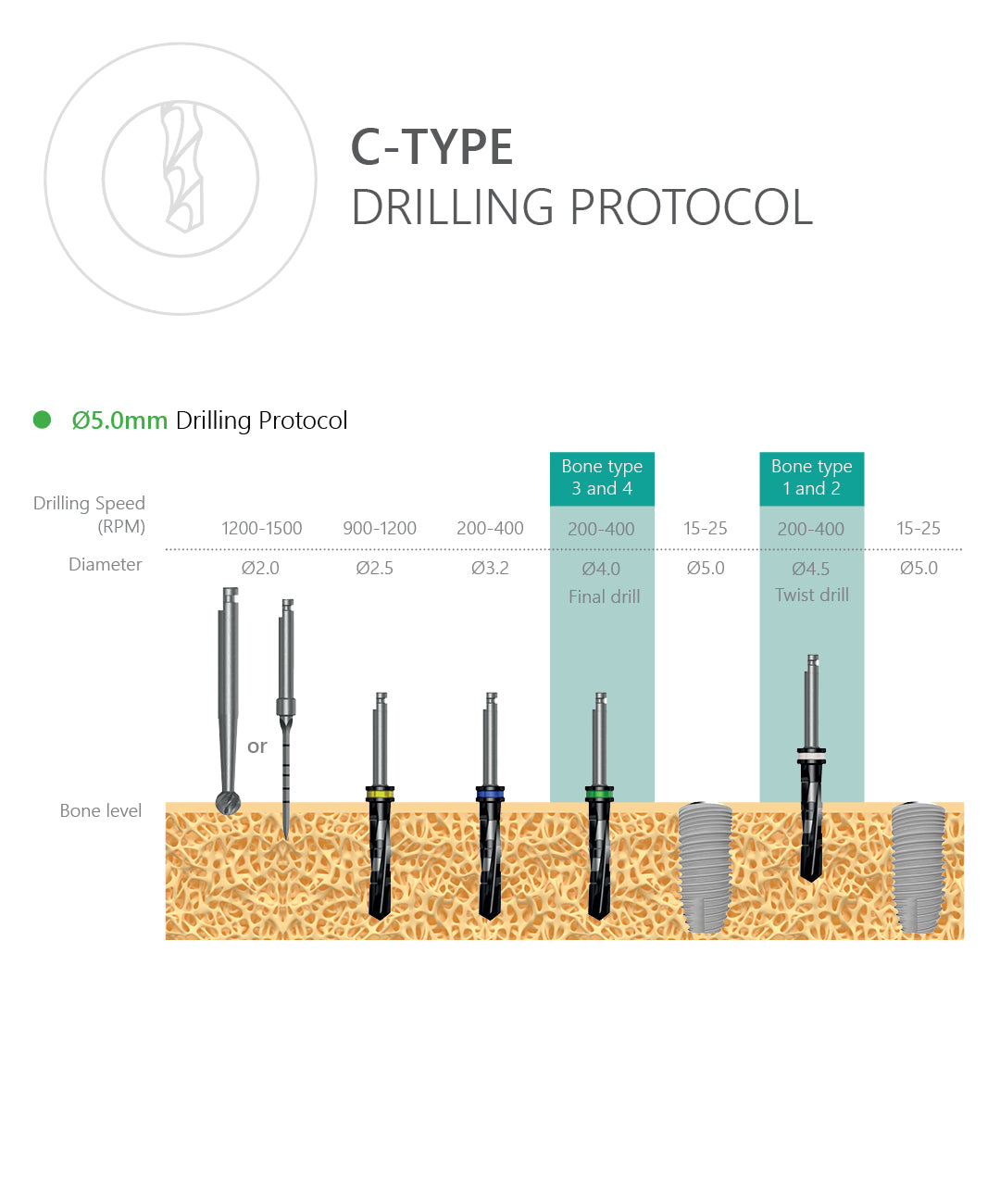 C-Type Dental Implant