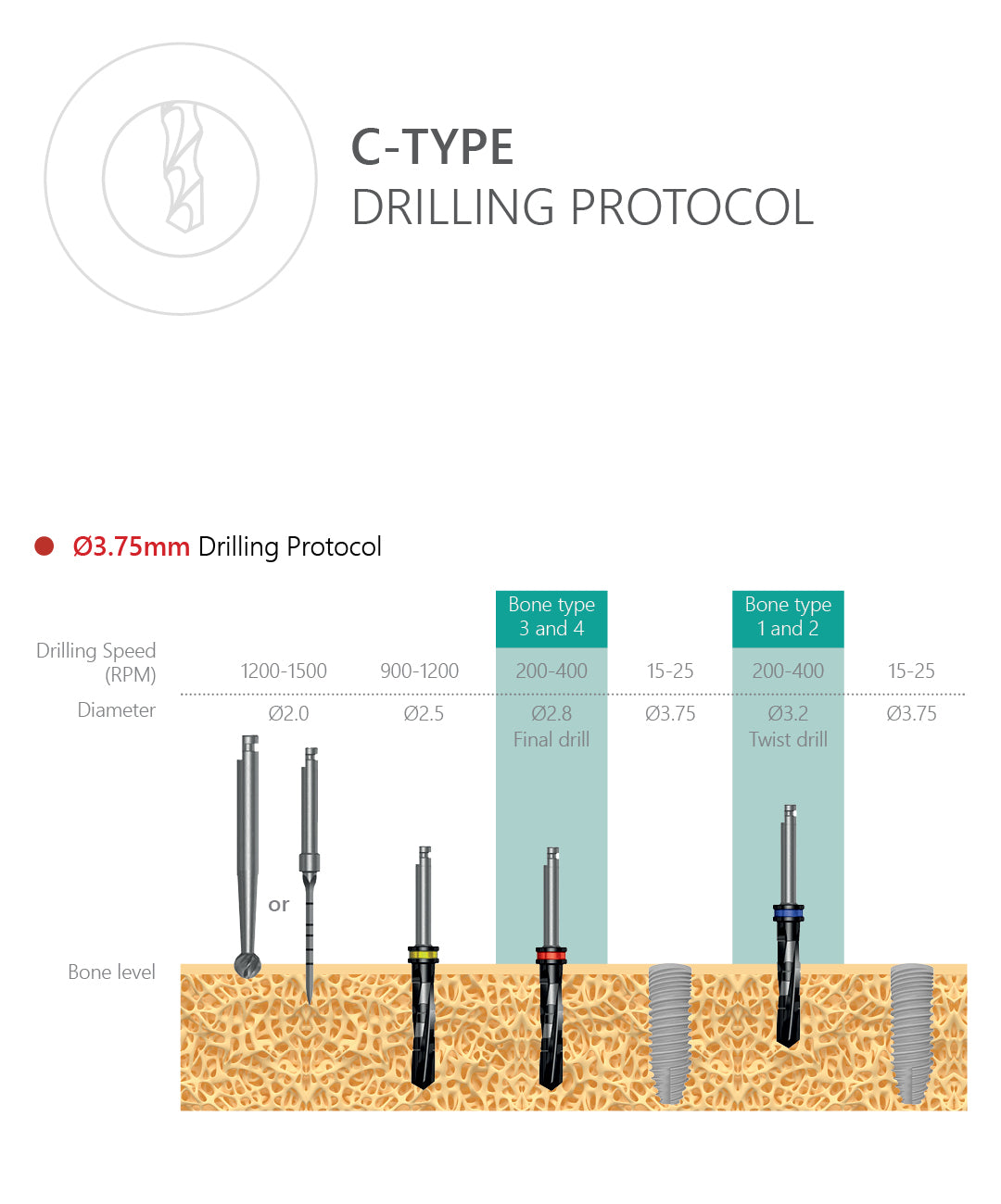 C-Type Implant Drilling Protocol 3.75