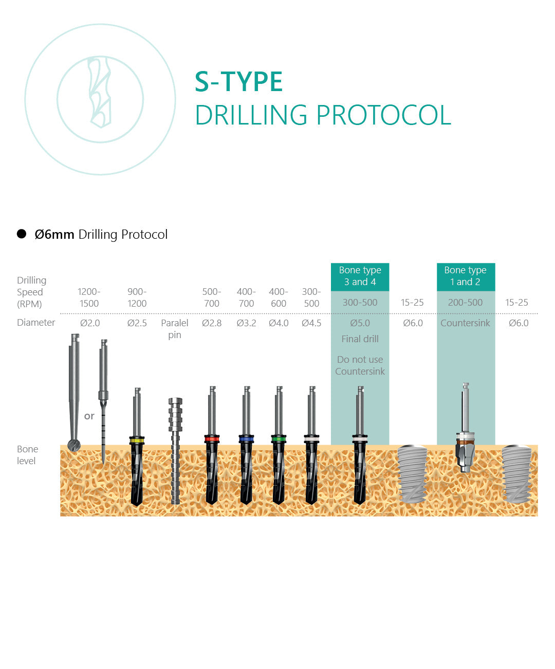 S-Type Dental Implant